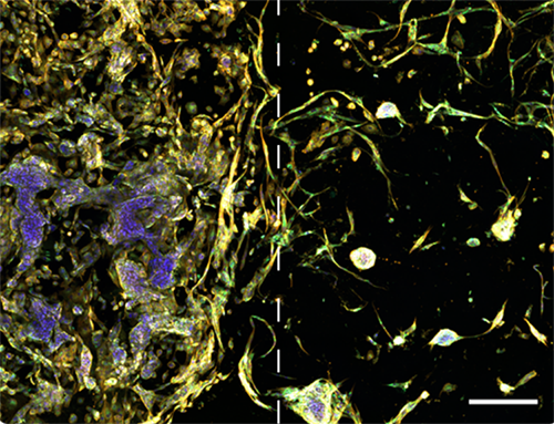 RASTRUM 3D cell model of the tumor microenvironment with spatial separation in RASTRUM’s Dual Matrix Model architecture