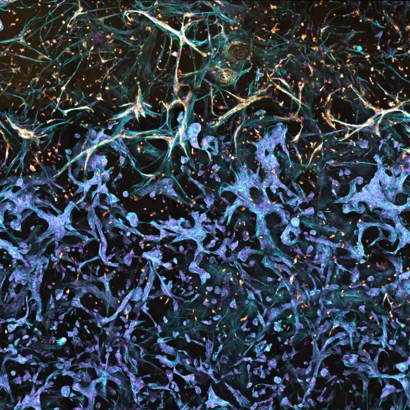 Fluorescent image of a 3D cancer cell model generated with RASTRUM™ tunable matrices, highlighting a complex microenvironment with diverse cell interactions. This model enhances physiological relevance for cancer research and drug discovery, supporting high-throughput, reproducible experimentation.