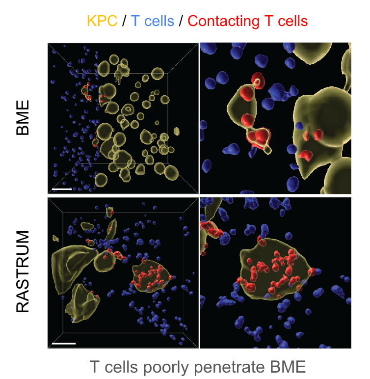 A comparison of activated cytotoxic T lymphocytes (CTLs) infiltration of pancreatic cancer cells cultured in 4.8kPa RASTRUM matrices compared to basement membrane extract (BME).