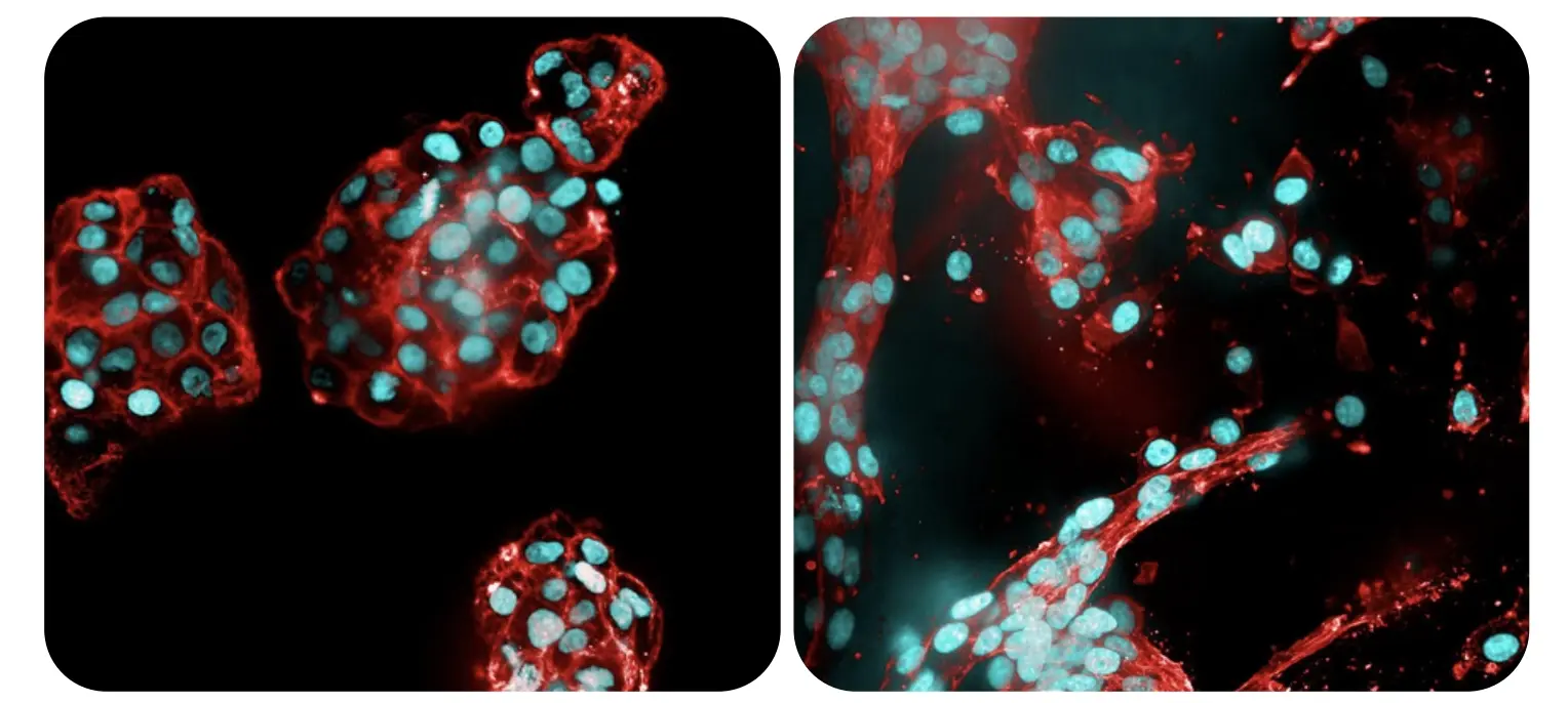 RASTRUM_Glioblastoma_U87