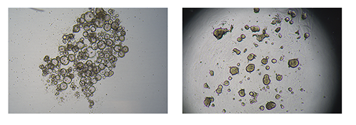 The figure depicts bright-field images of patient-derived colorectal cancer cells grown as tumoroids in suspension cultures at day 6 (left) or in Px02 RASTRUM matrices at day 7 (right).