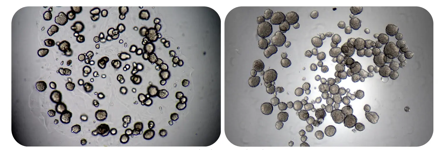 RASTRUM_TumorSpheroids_Recovery-1